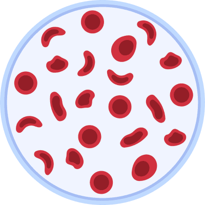 Anemia